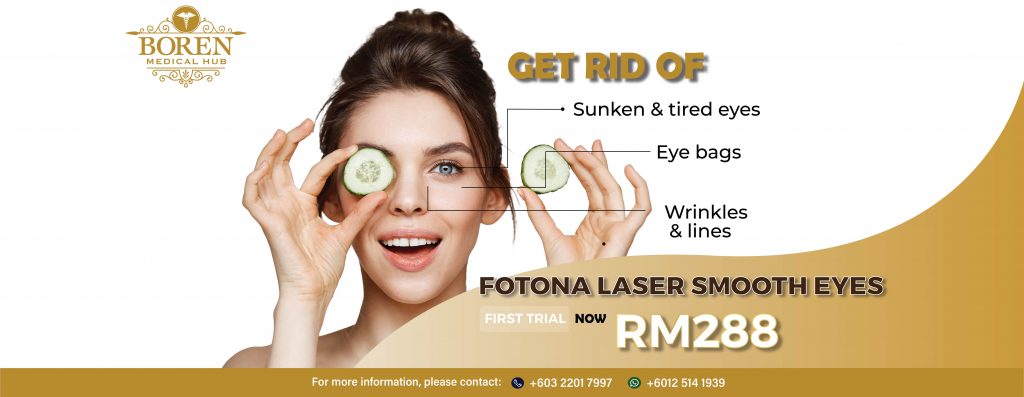 FOTONA Smooth Eyes only at RM 288! - Boren Medical Hub